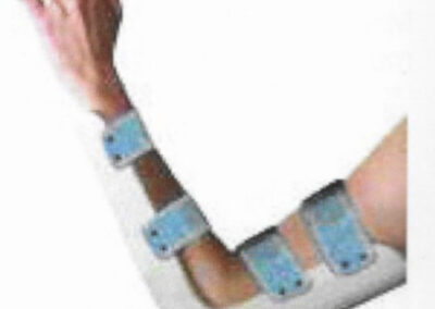Orthèse de coude sur-mesure en plastique thermoformé