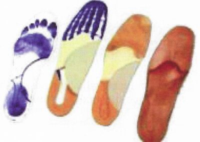 De l'empreinte à la semelle sur-mesure terminée