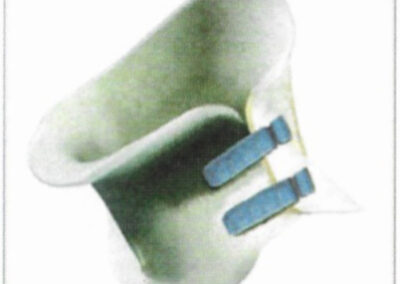 Collier cervical sur-mesure d'après moulage