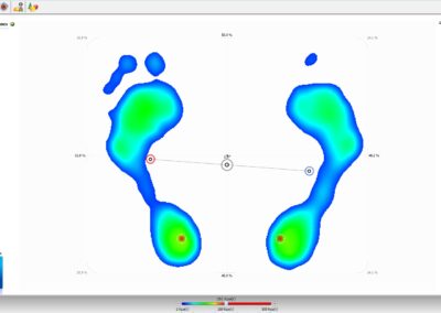 Empreintes de pied réalisées au moyen d'un podoscope/podographe numérique
